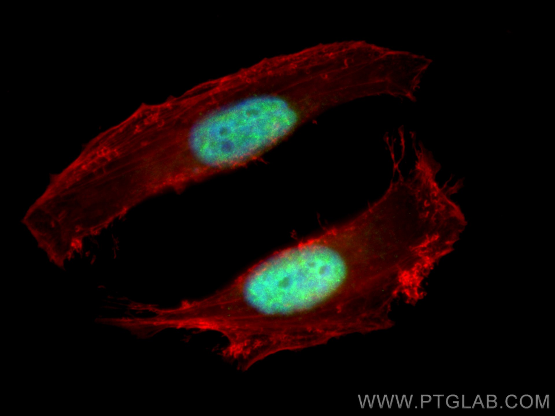 IF Staining of HeLa using 16047-1-AP