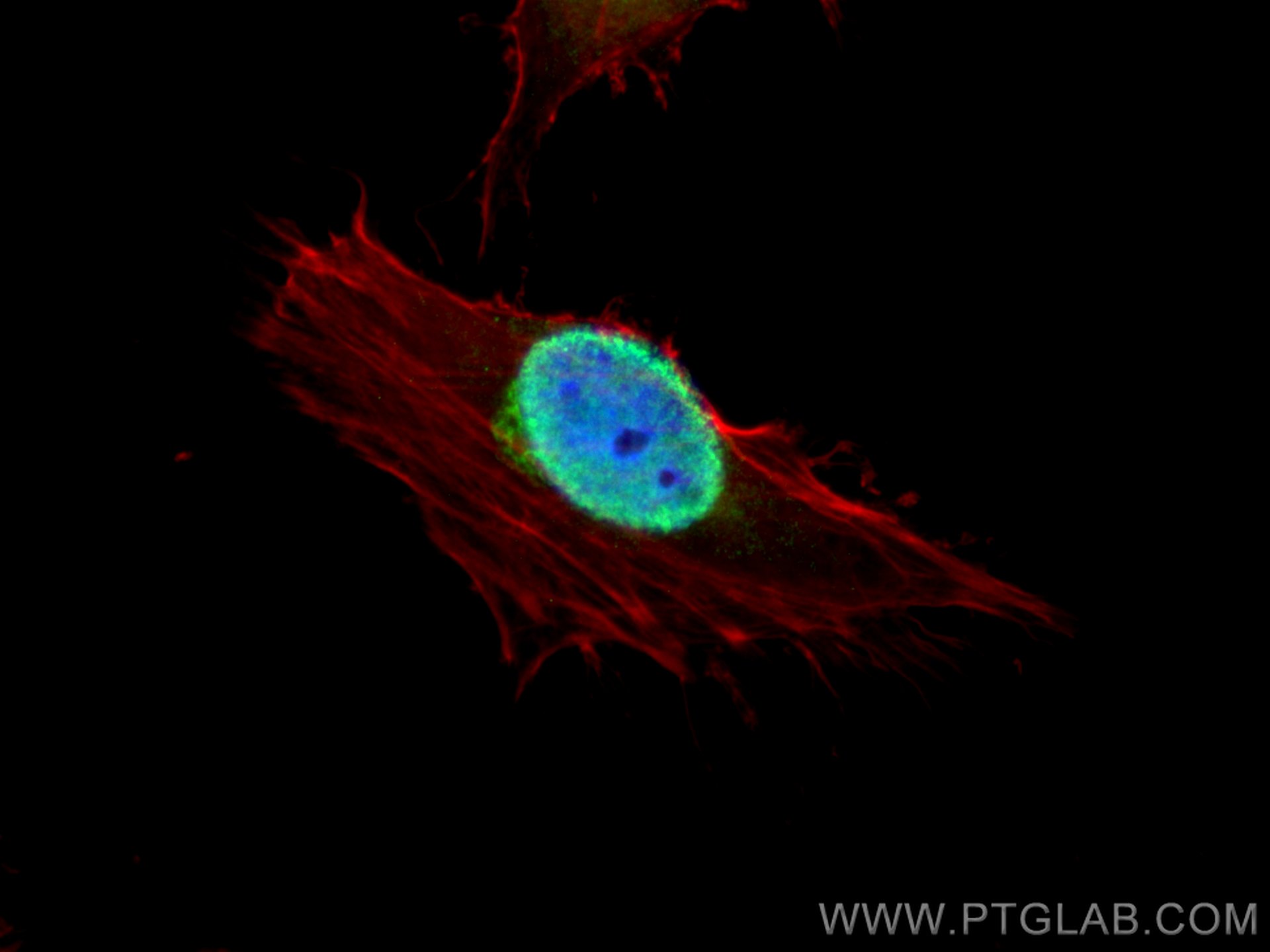 IF Staining of HeLa using 16047-1-AP