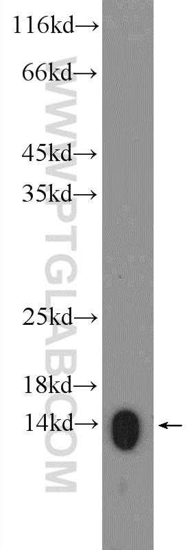 WB analysis of L02 using 15302-1-AP