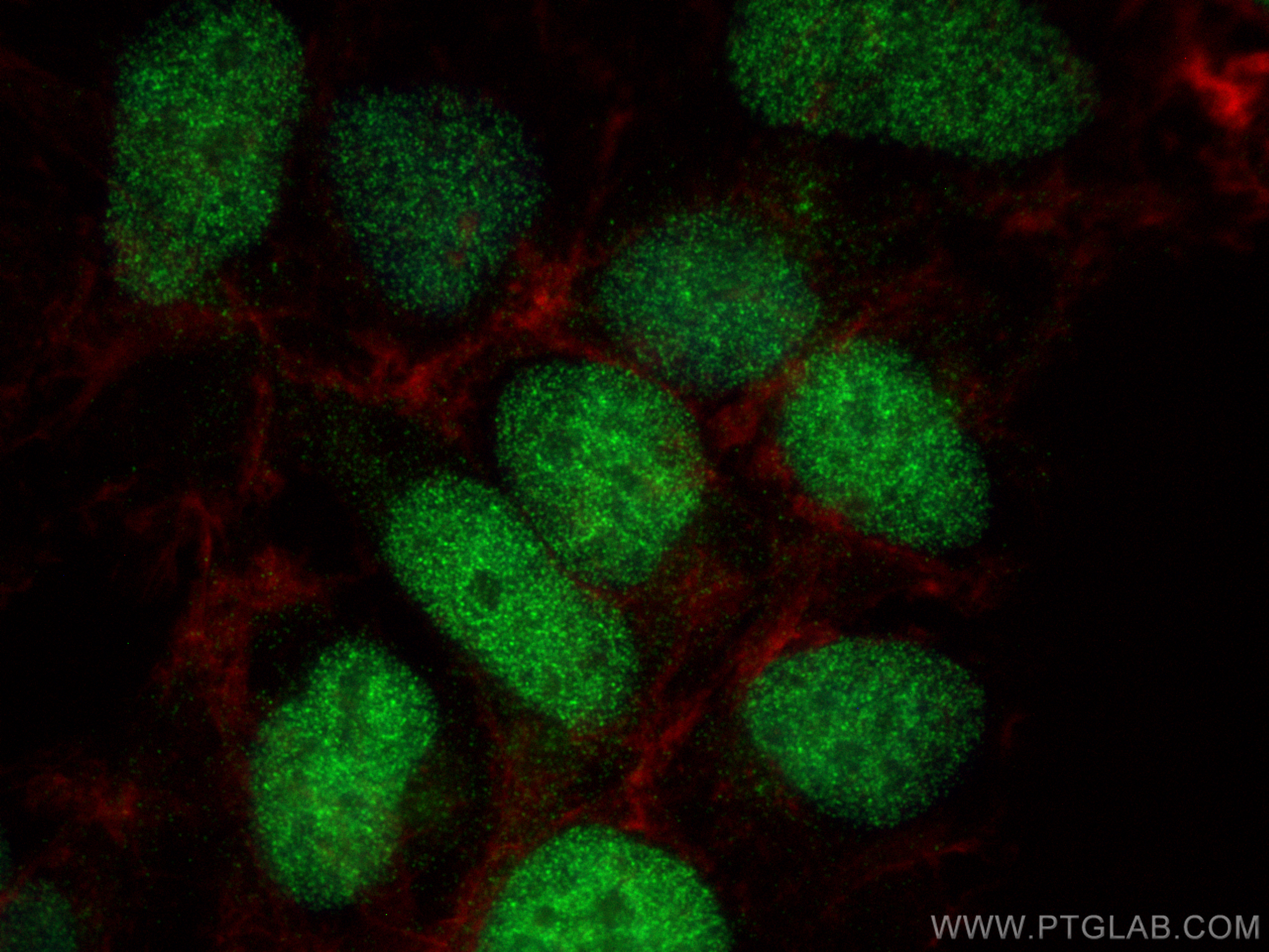 IF Staining of HEK-293 using 27740-1-AP