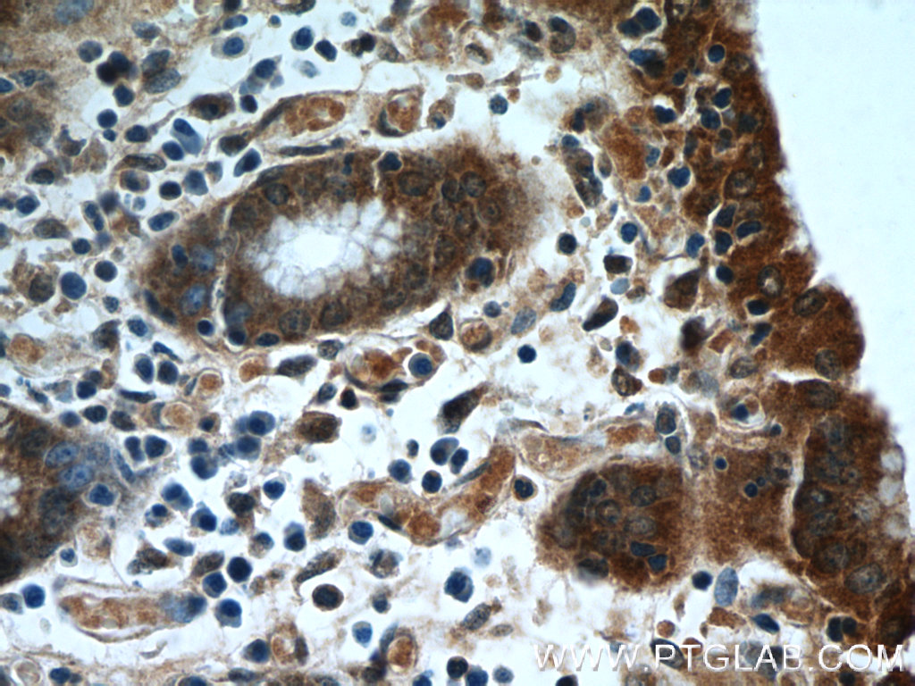 IHC staining of human stomach using 25168-1-AP