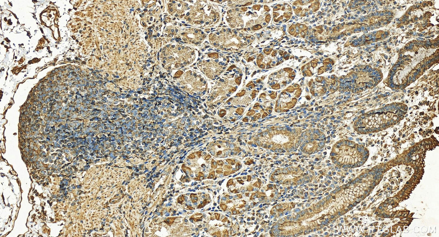 IHC staining of human stomach using 15656-1-AP