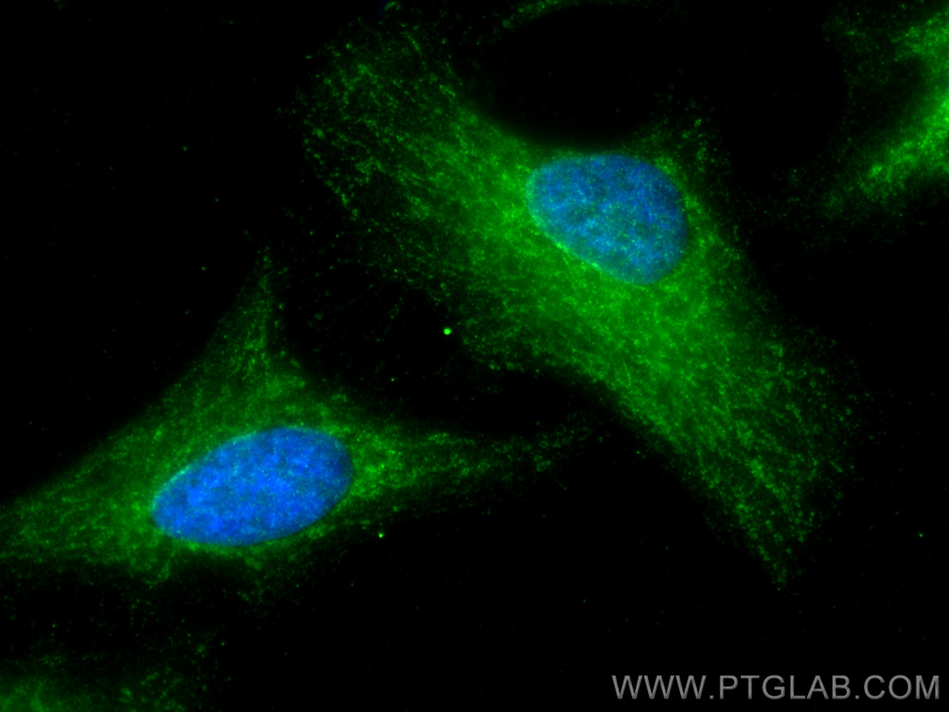 Hexokinase 1