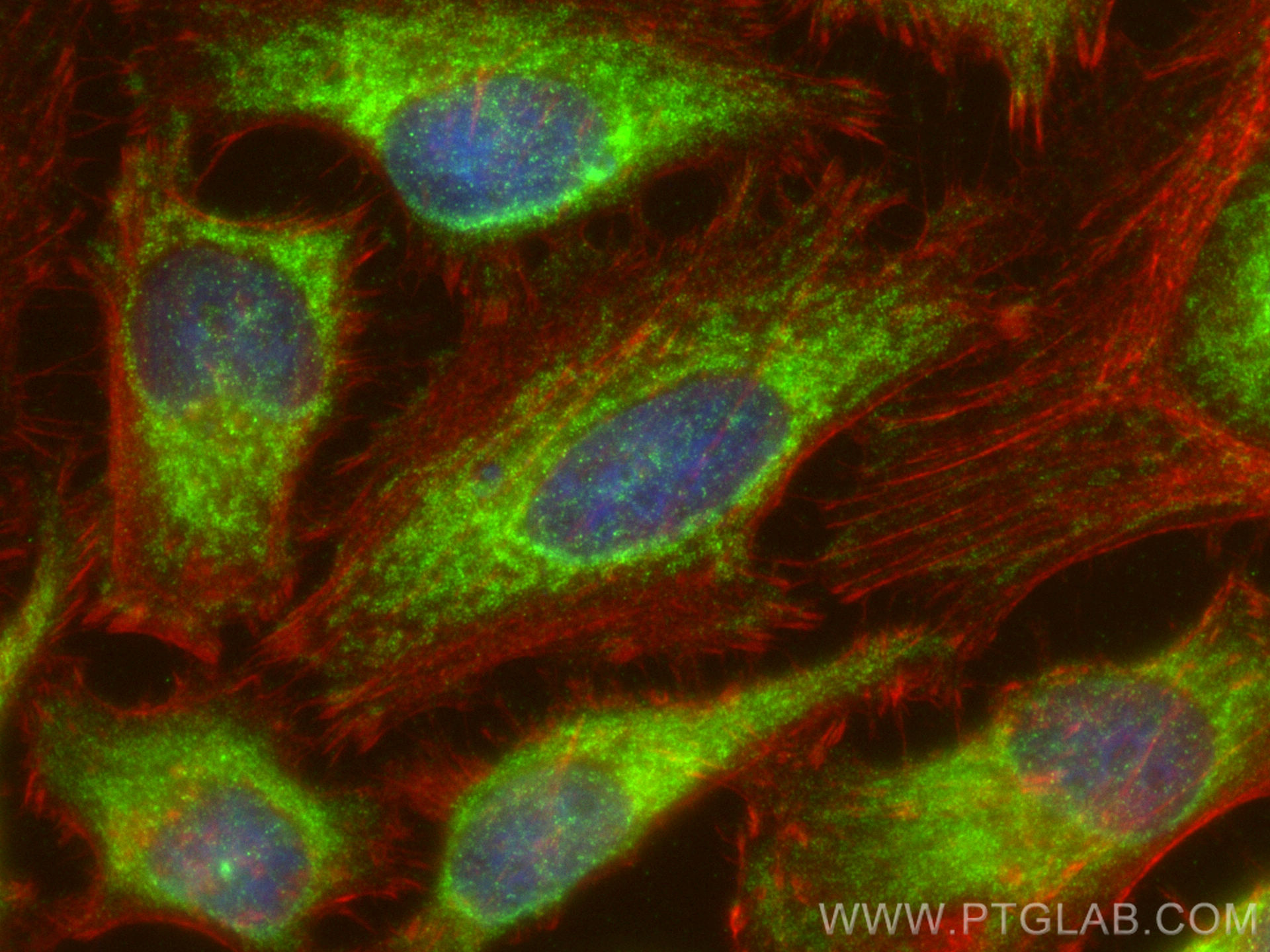 IF Staining of HeLa using 19662-1-AP