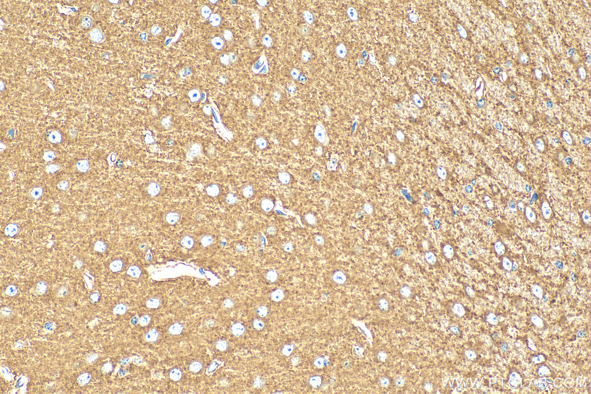 IHC staining of mouse brain using 19662-1-AP