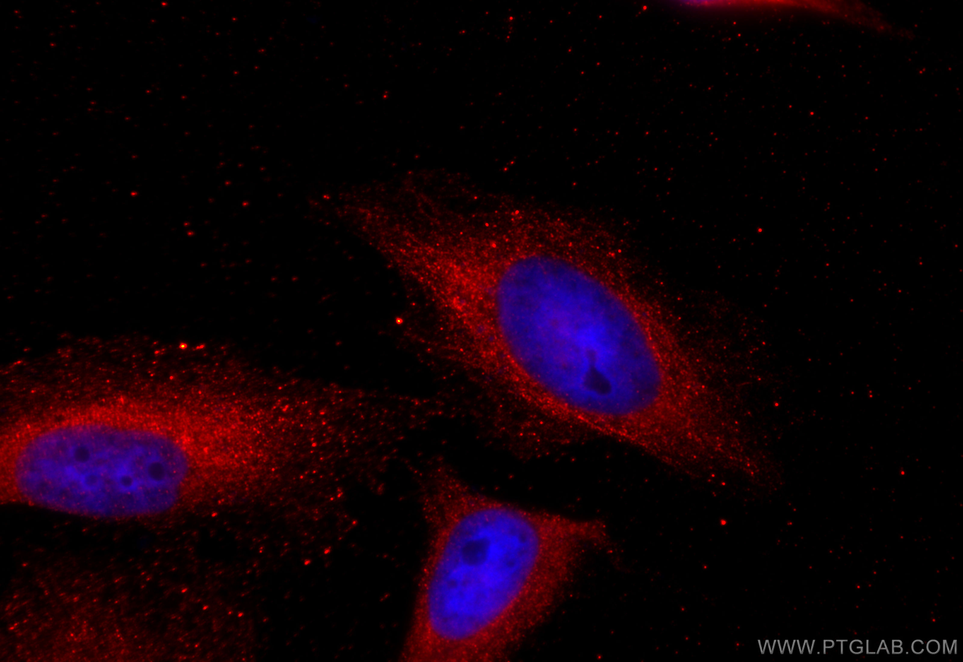 IF Staining of HeLa using 22029-1-AP