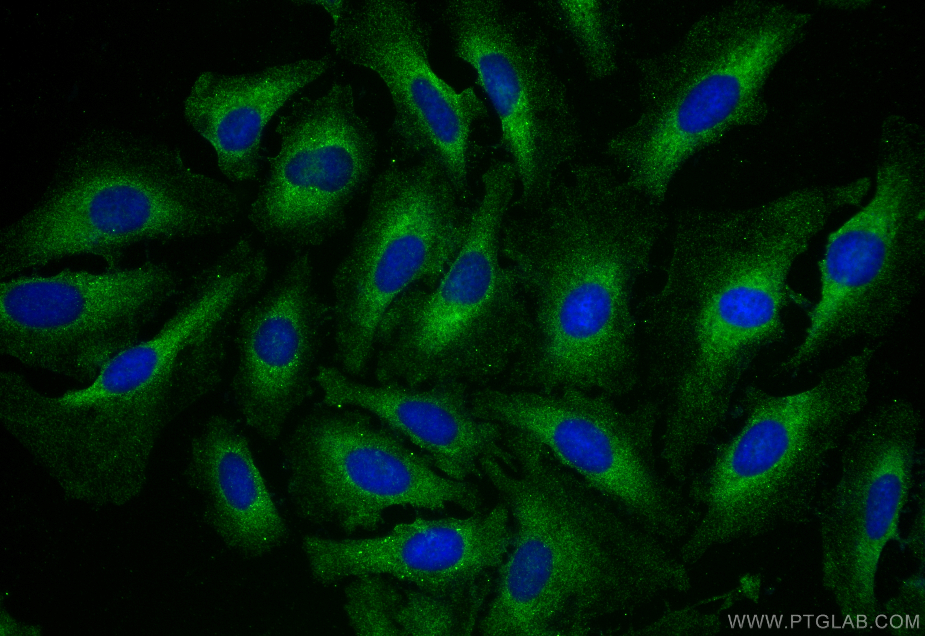 IF Staining of HeLa using 66974-1-Ig (same clone as 66974-1-PBS)