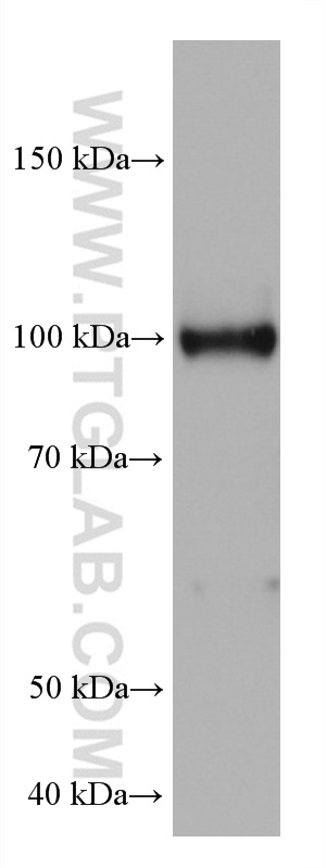 WB analysis of rat spleen using 67803-1-Ig (same clone as 67803-1-PBS)