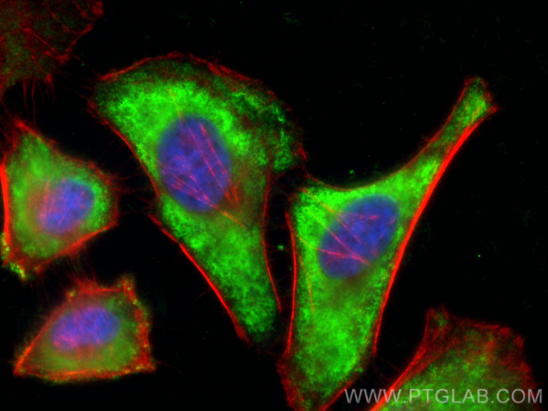 IF Staining of HeLa using CL488-67803