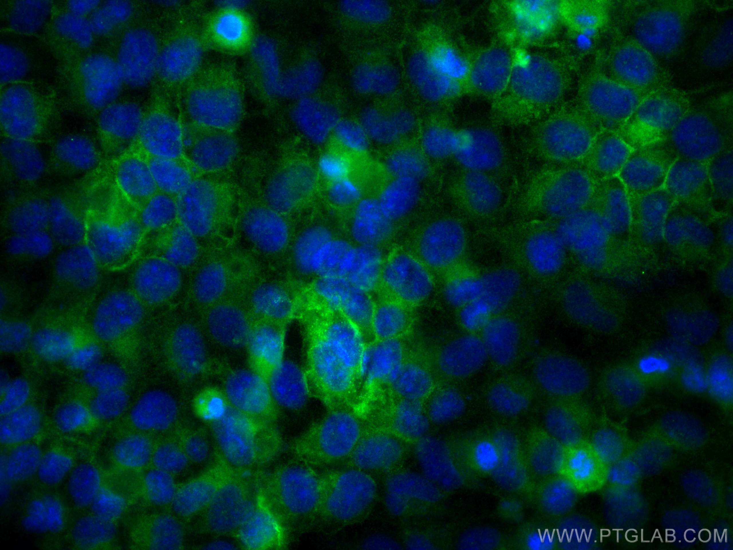 IF Staining of HeLa using 15777-1-AP