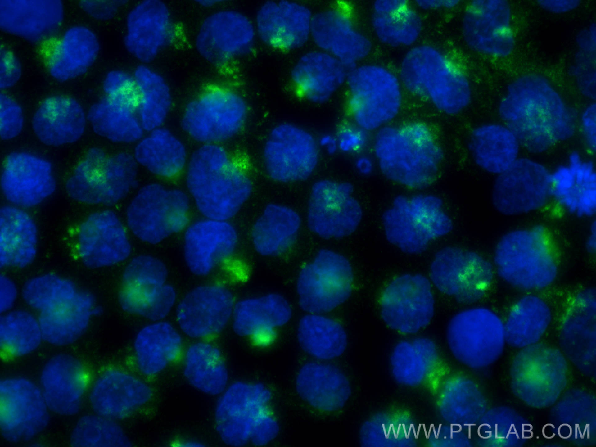 IF Staining of Raji using 82922-1-RR (same clone as 82922-1-PBS)