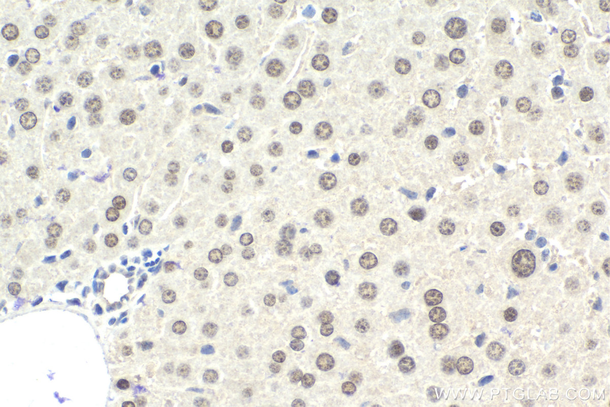 IHC staining of mouse liver using 12870-1-AP