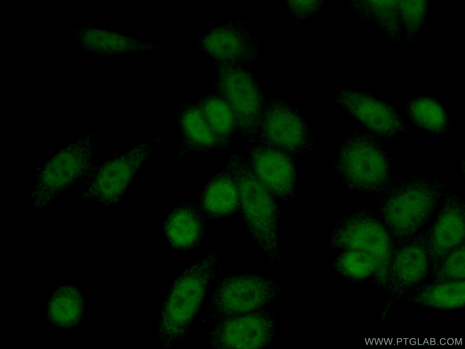 IF Staining of HeLa using 14286-1-AP