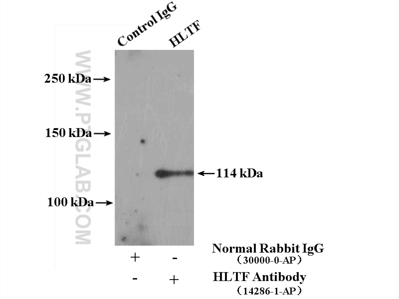 IP experiment of HeLa using 14286-1-AP