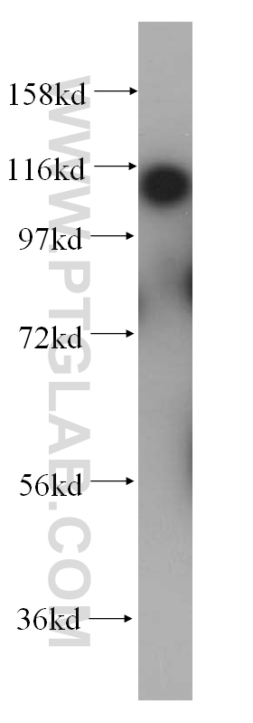 WB analysis of HeLa using 14286-1-AP