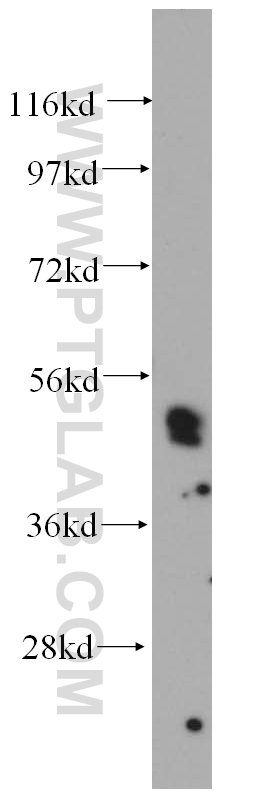 WB analysis of human placenta using 14336-1-AP