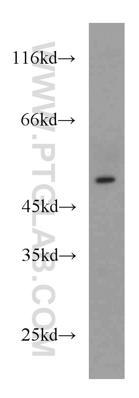 WB analysis of mouse brain using 16123-1-AP