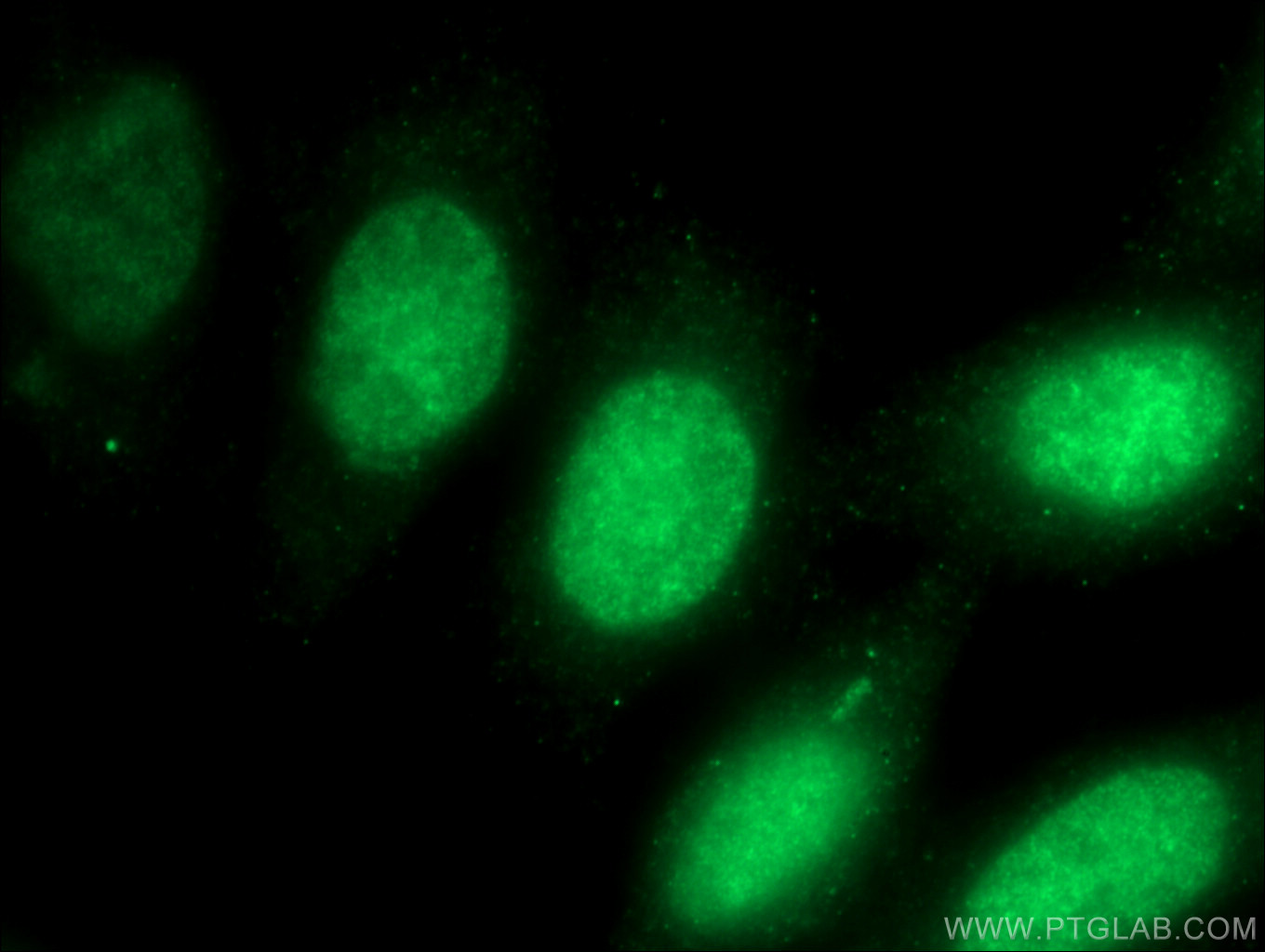 IF Staining of HepG2 using 12085-2-AP