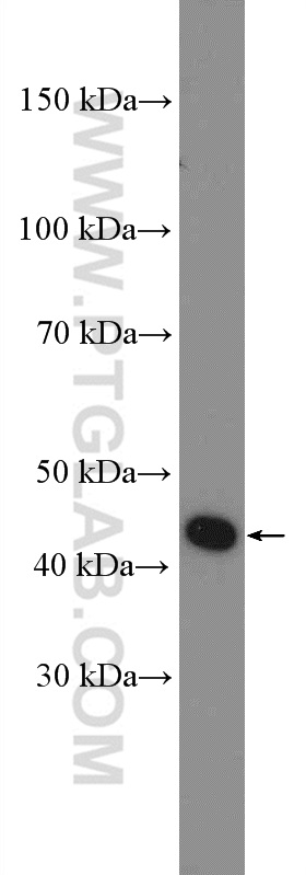 WB analysis of Jurkat using 12085-2-AP