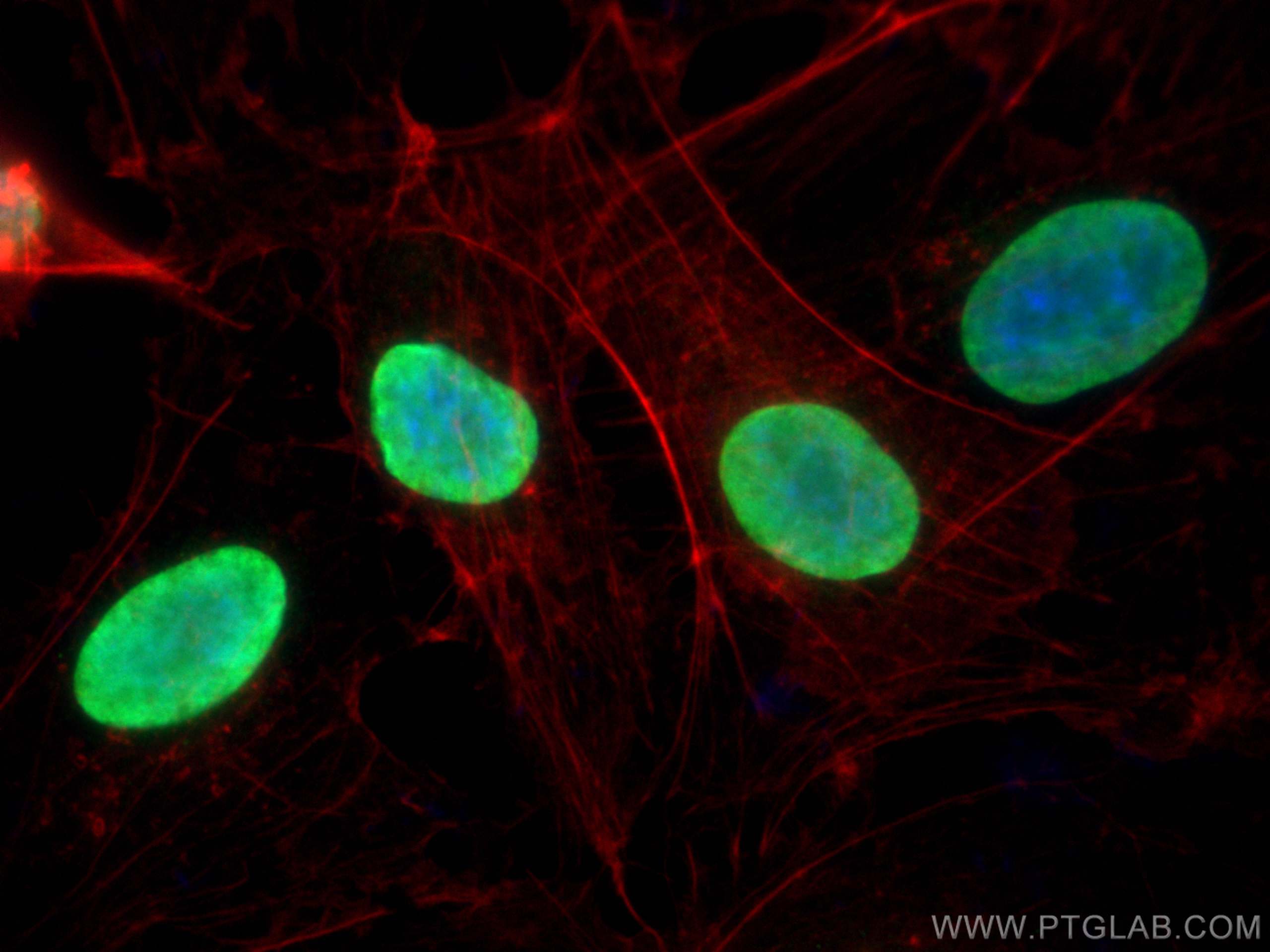 IF Staining of HUVEC using 29895-1-AP