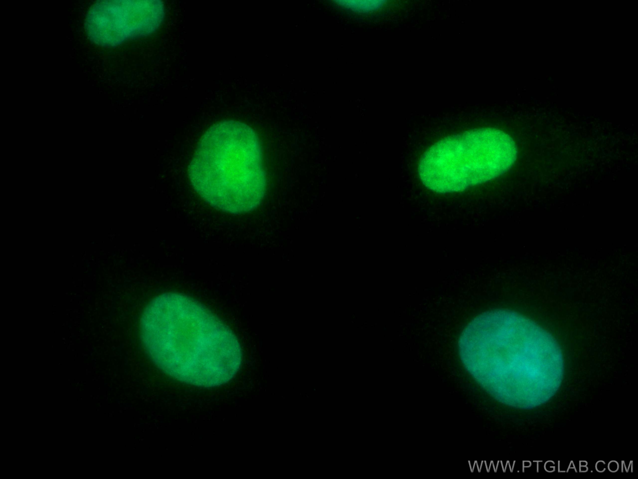 IF Staining of A549 using CL488-20795