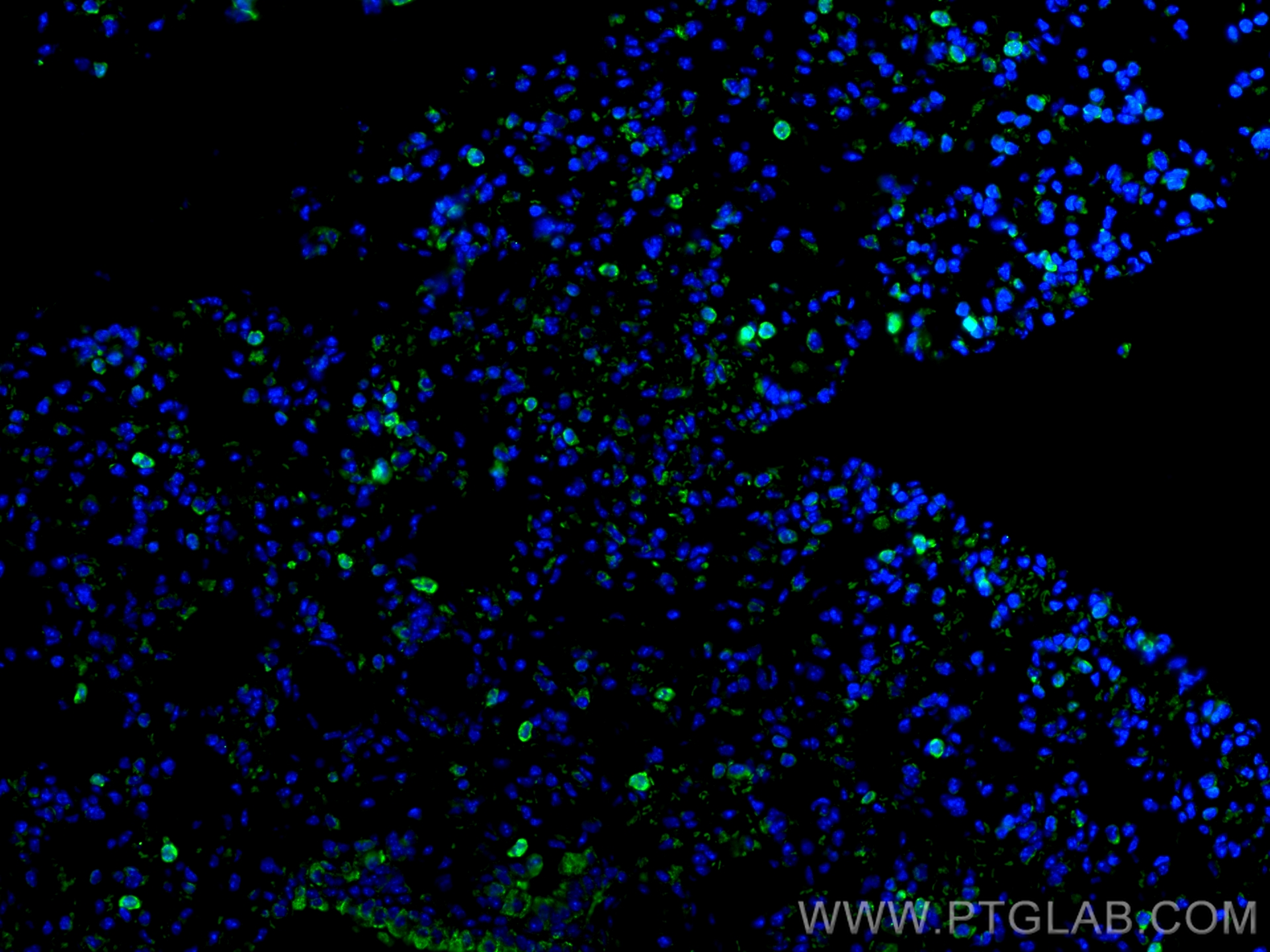 IF Staining of mouse lung using 66525-1-Ig