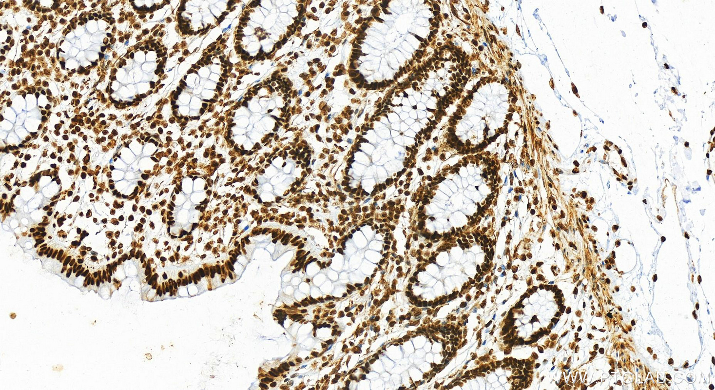 IHC staining of human colon using 82973-1-RR (same clone as 82973-1-PBS)