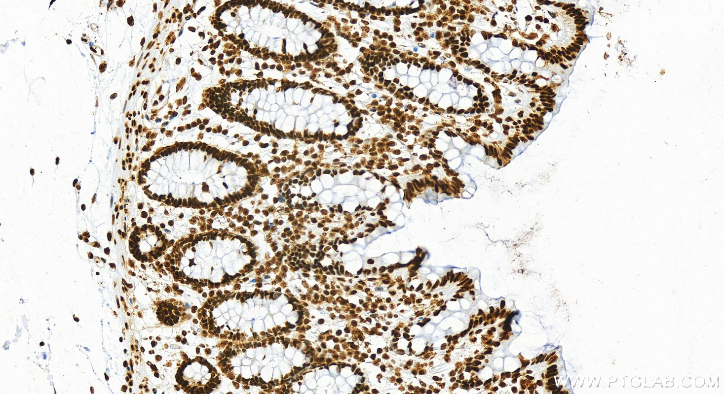 IHC staining of human normal colon using 82973-1-RR