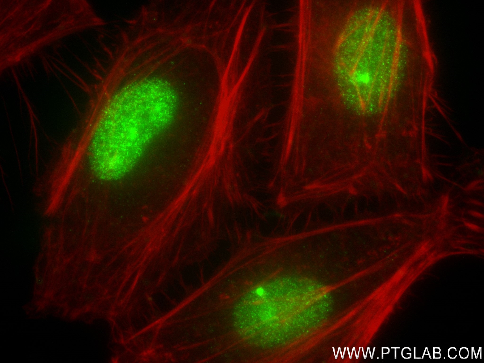 IF Staining of HeLa using 82973-1-RR