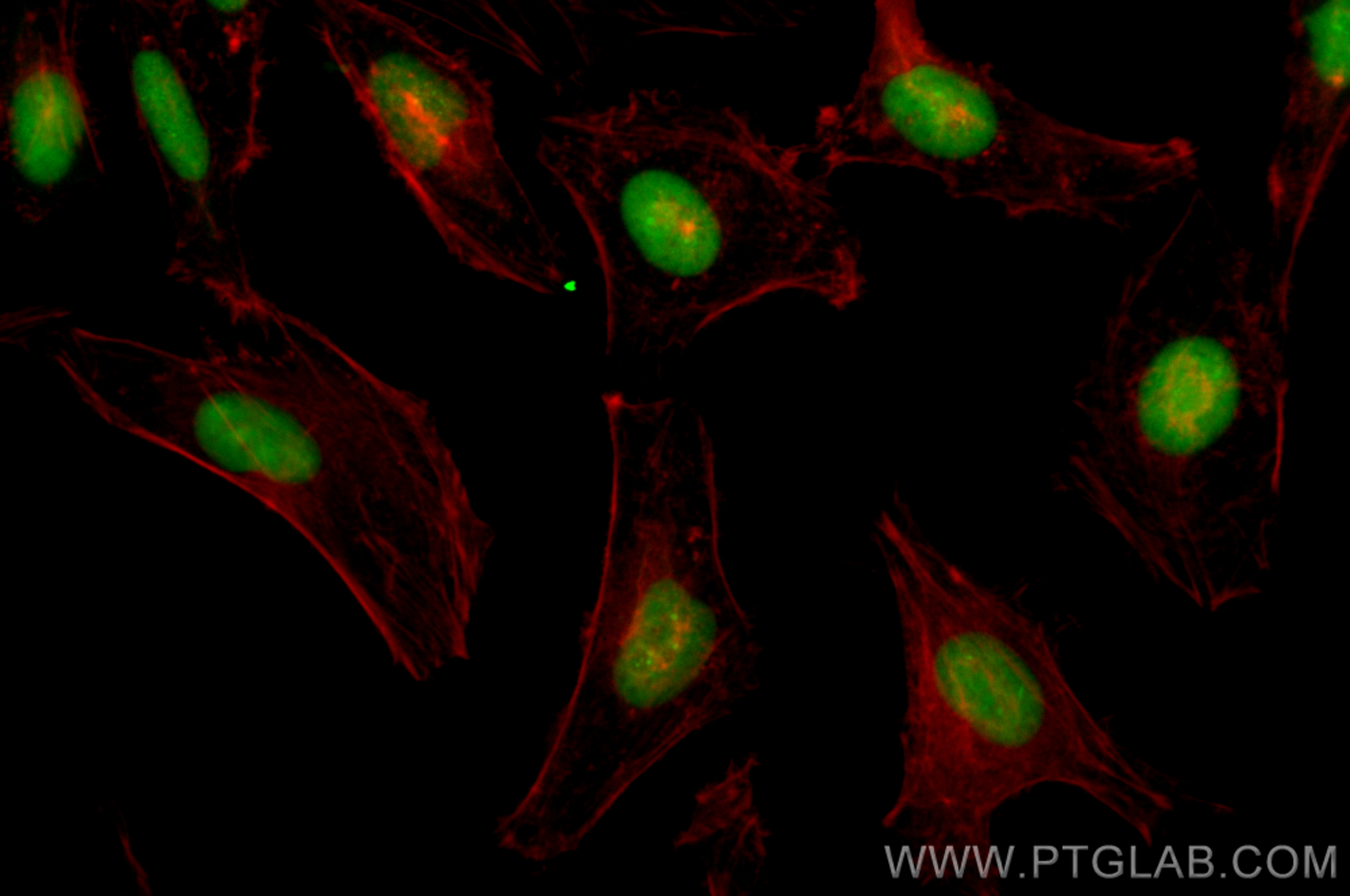 IF Staining of HeLa using CL488-82973