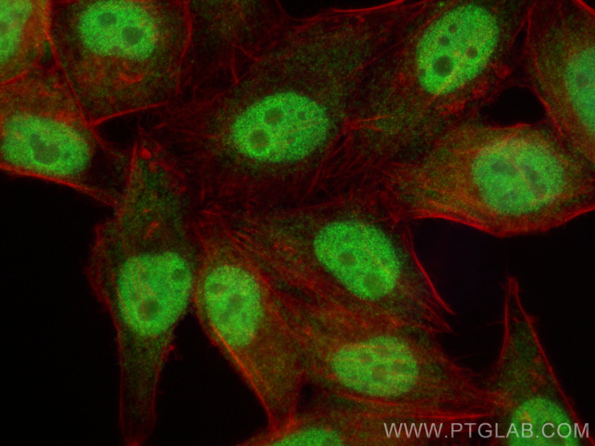 IF Staining of HepG2 using 14597-1-AP