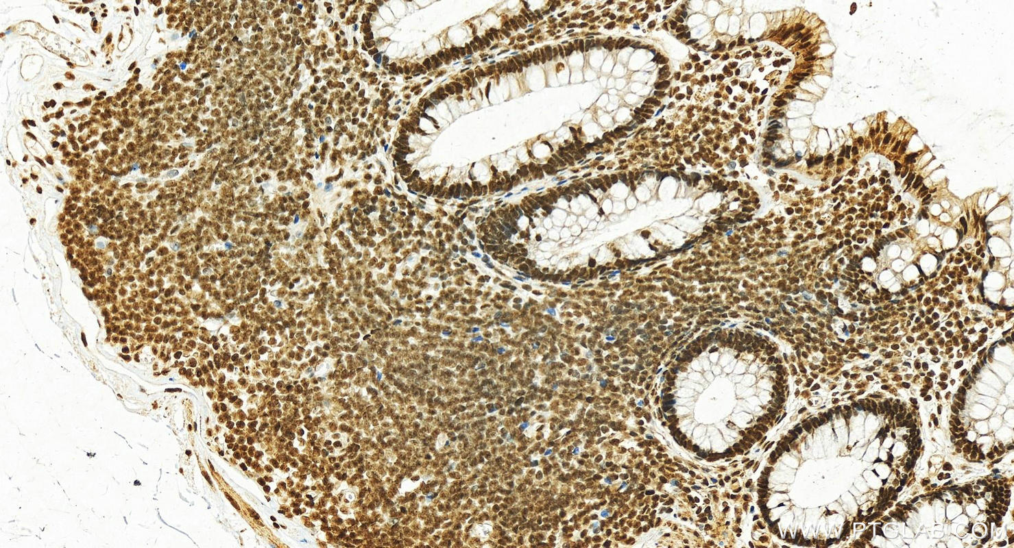 IHC staining of human normal colon using 15605-1-AP