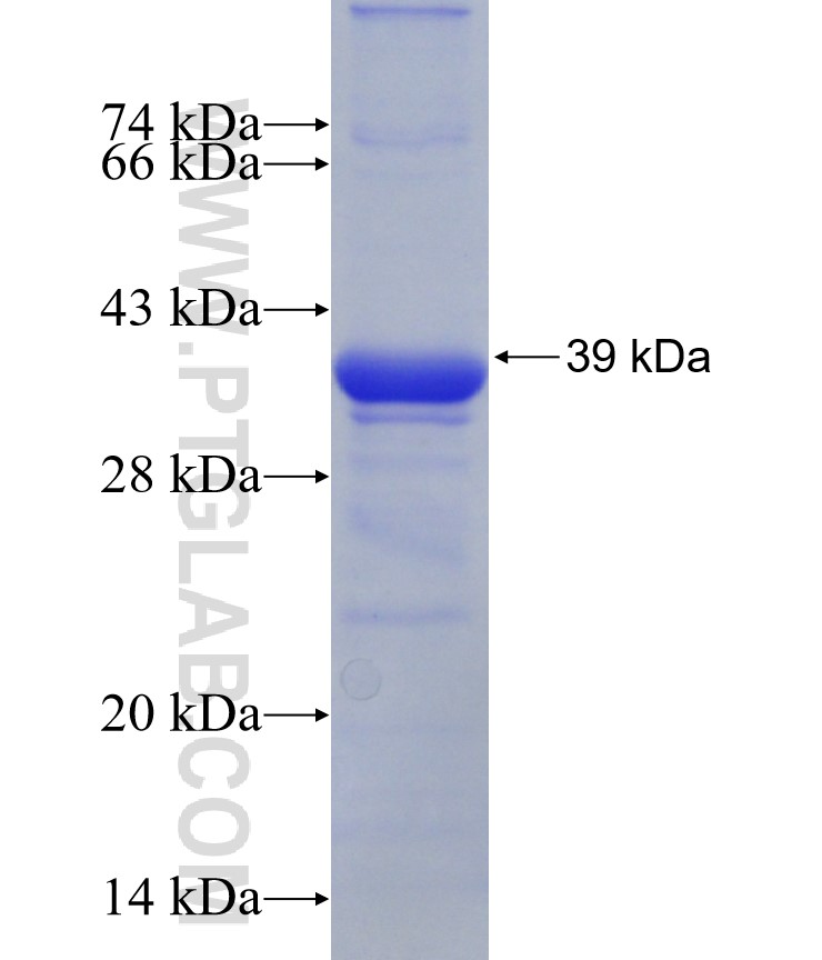 HMGCR fusion protein Ag29287 SDS-PAGE