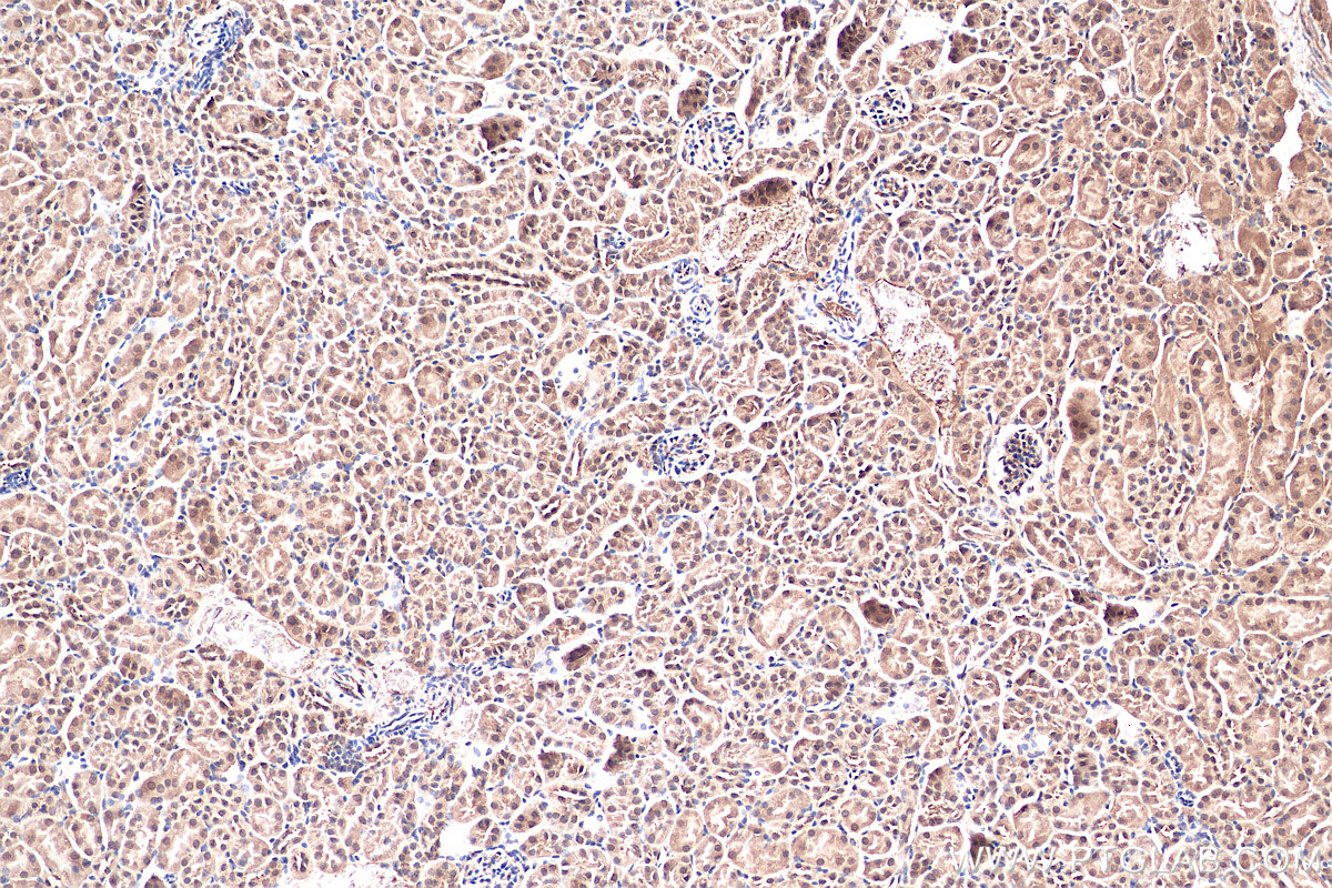 IHC staining of mouse kidney using 11695-1-AP