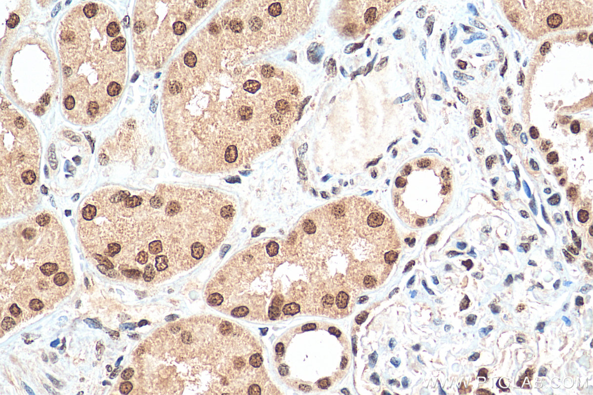 IHC staining of human kidney using 11695-1-AP