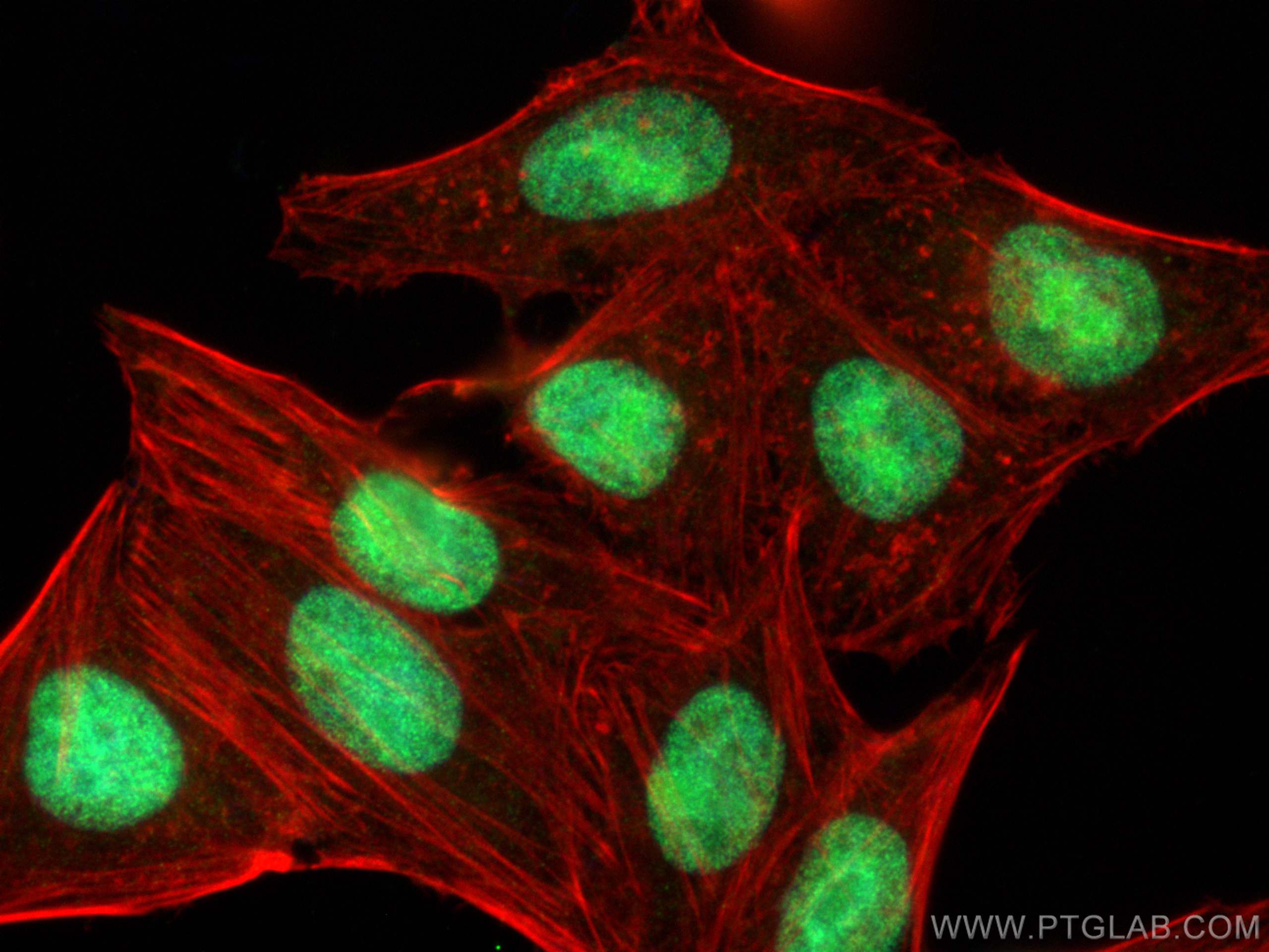 IF Staining of HepG2 using 10953-1-AP