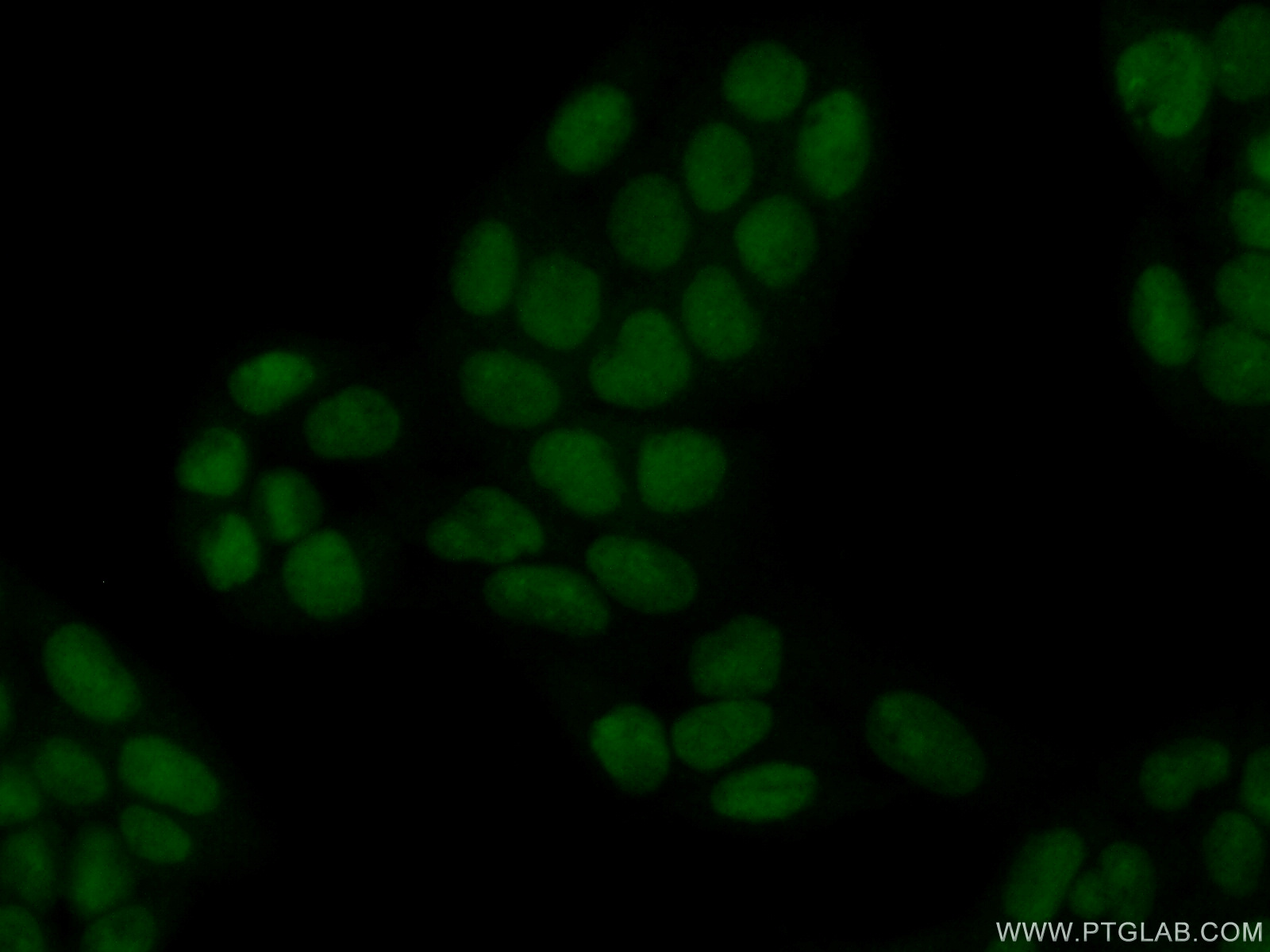 IF Staining of HeLa using 11686-1-AP