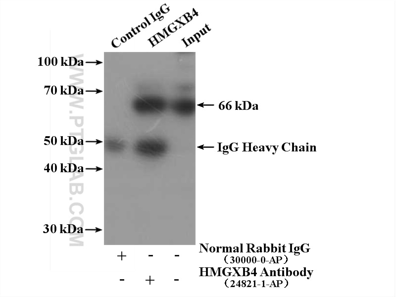 IP experiment of HeLa using 24821-1-AP