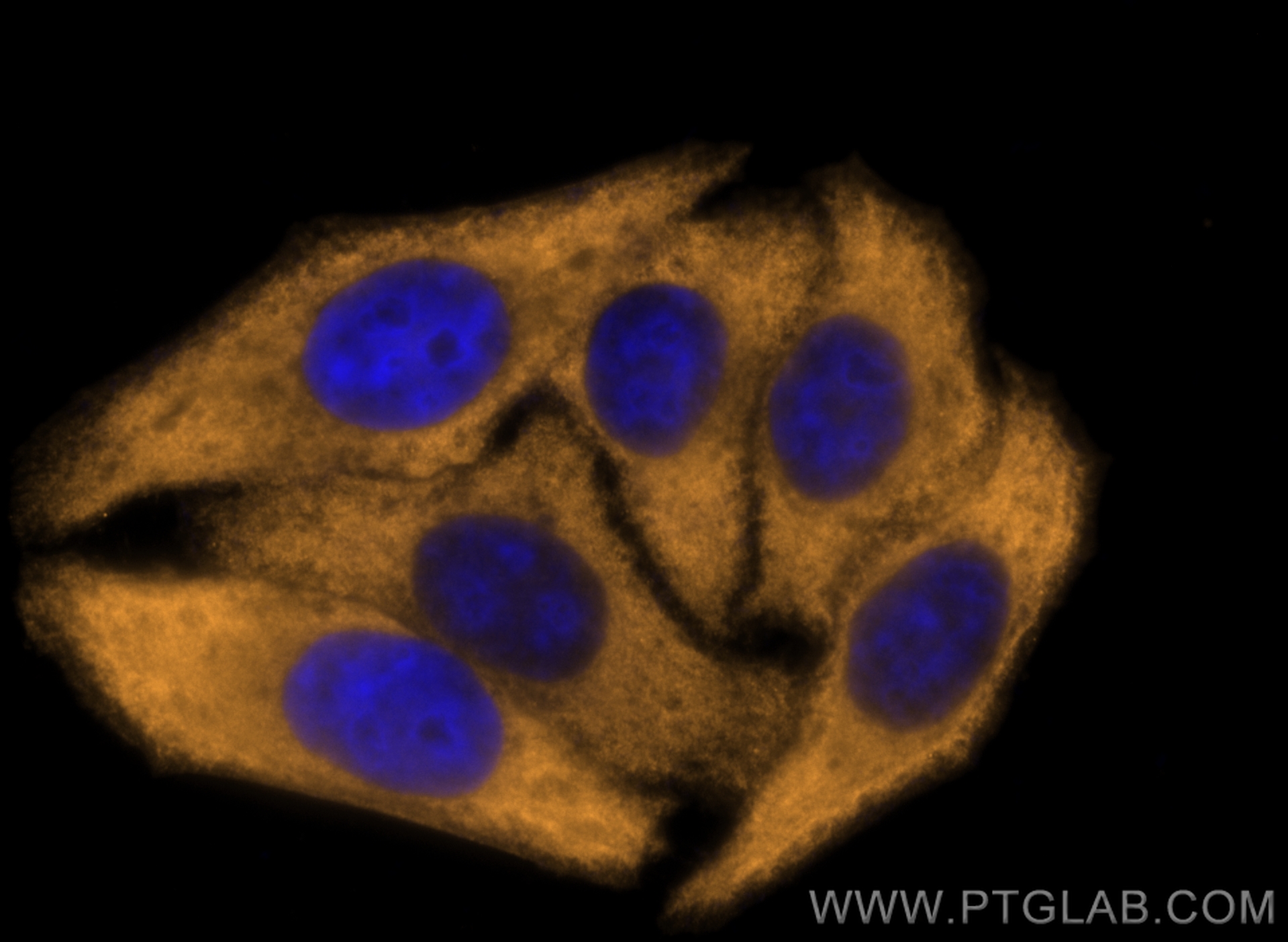 IF Staining of HepG2 using CL555-15820