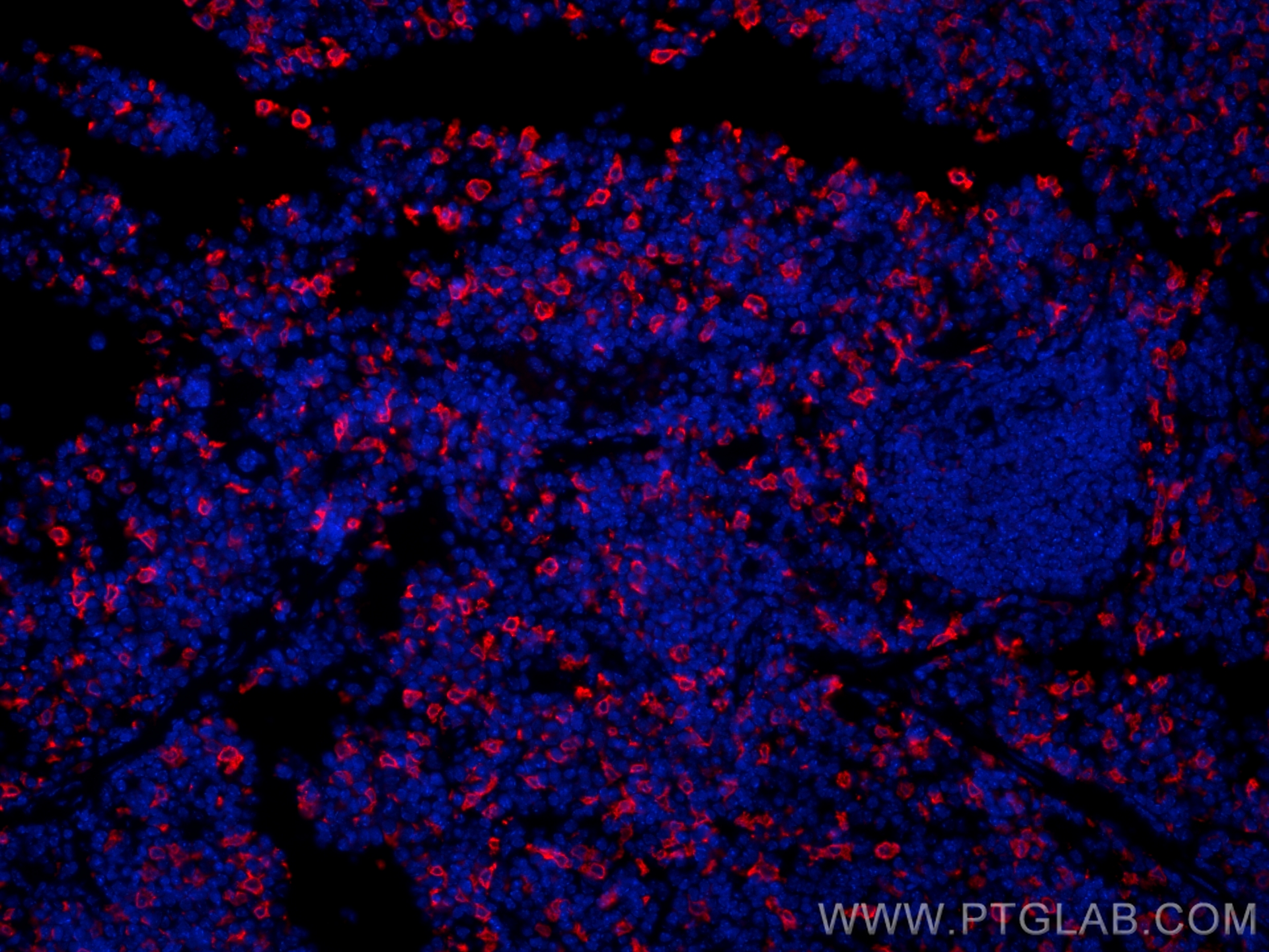 IF Staining of mouse spleen using 10701-1-AP