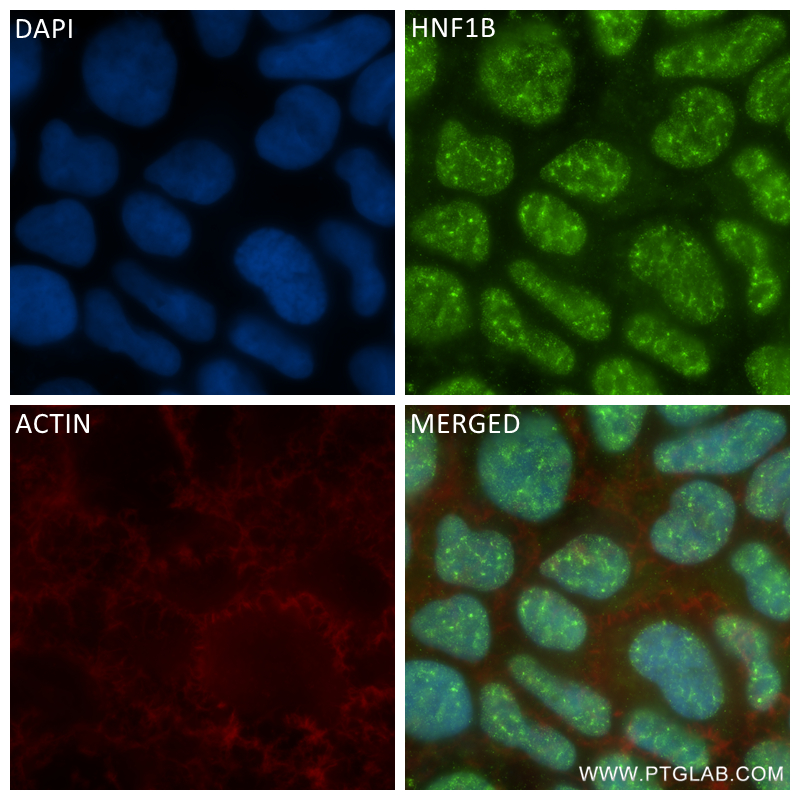 IF Staining of Caco-2 using 84684-5-RR (same clone as 84684-5-PBS)