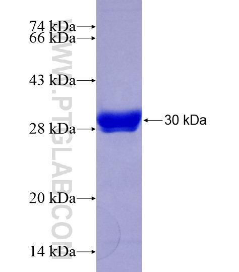 HNF1B fusion protein Ag19896 SDS-PAGE