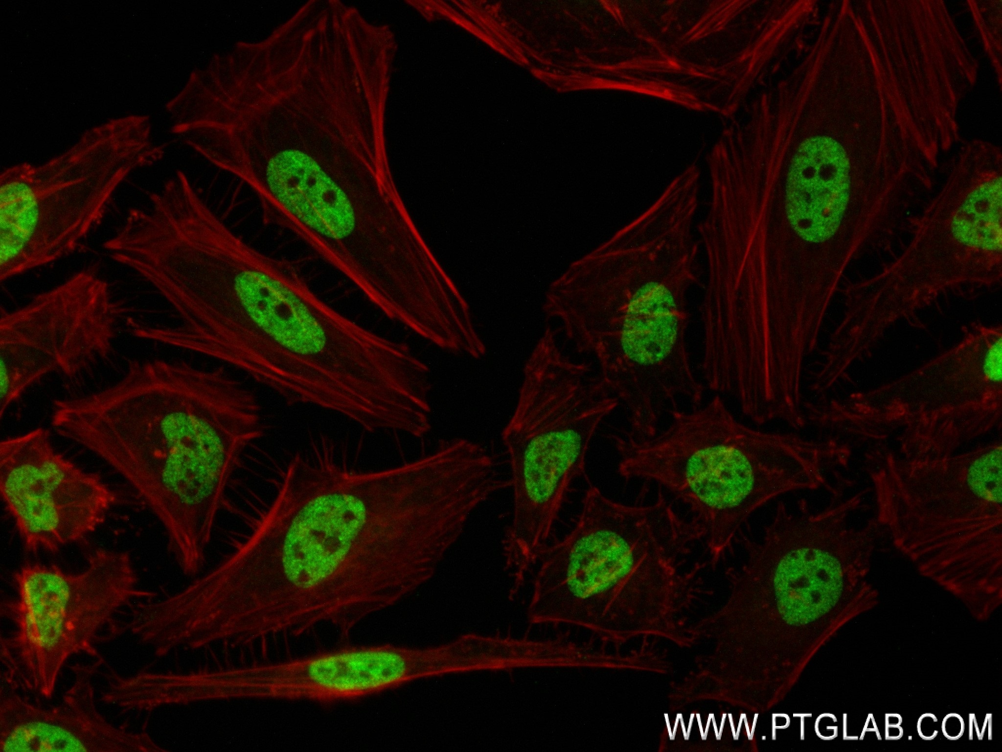 IF Staining of HeLa using 84316-7-RR (same clone as 84316-7-PBS)