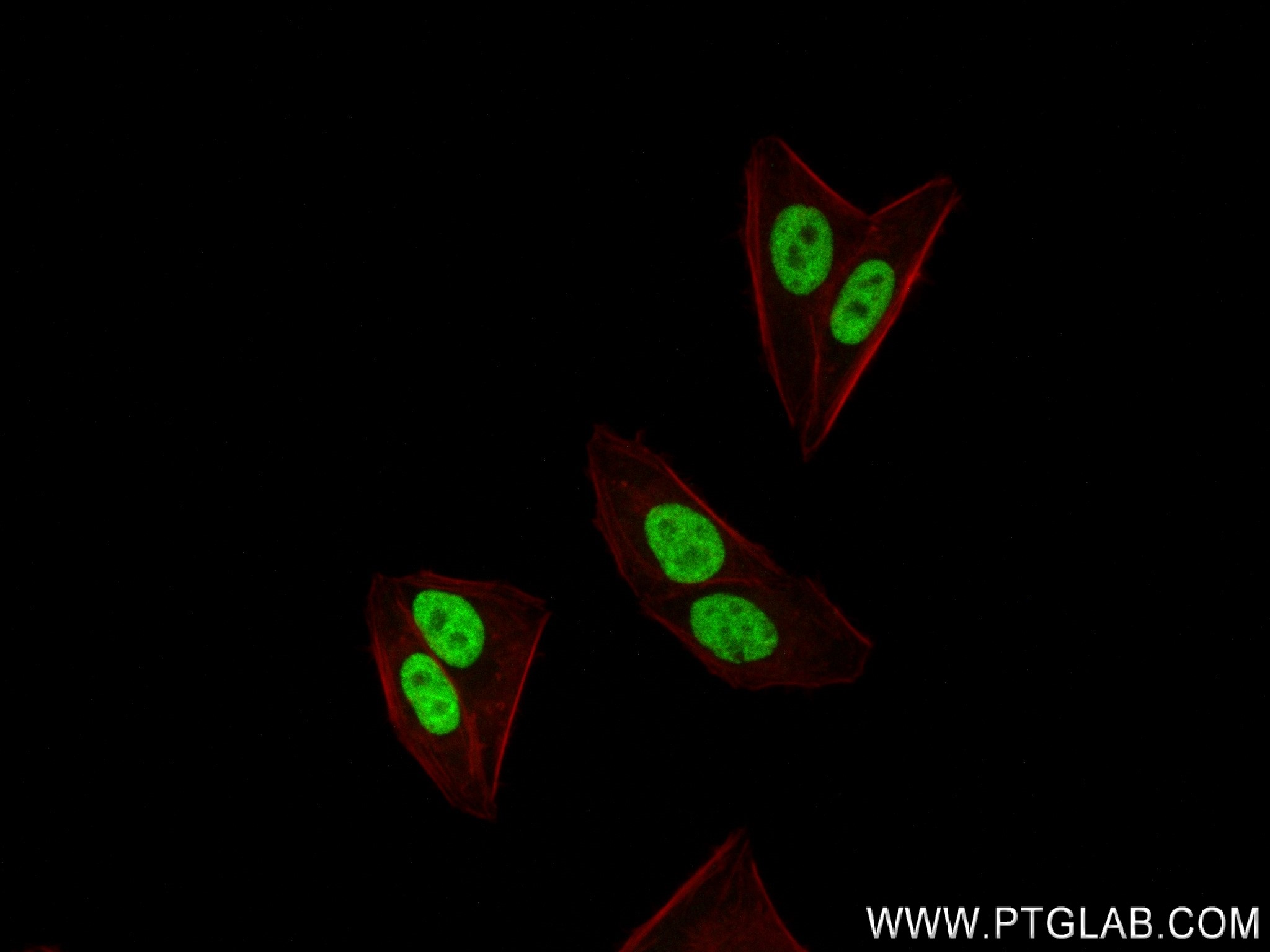 IF Staining of HepG2 using 84316-7-RR (same clone as 84316-7-PBS)