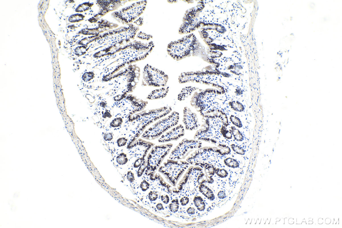 IHC staining of mouse small intestine using 25801-1-AP