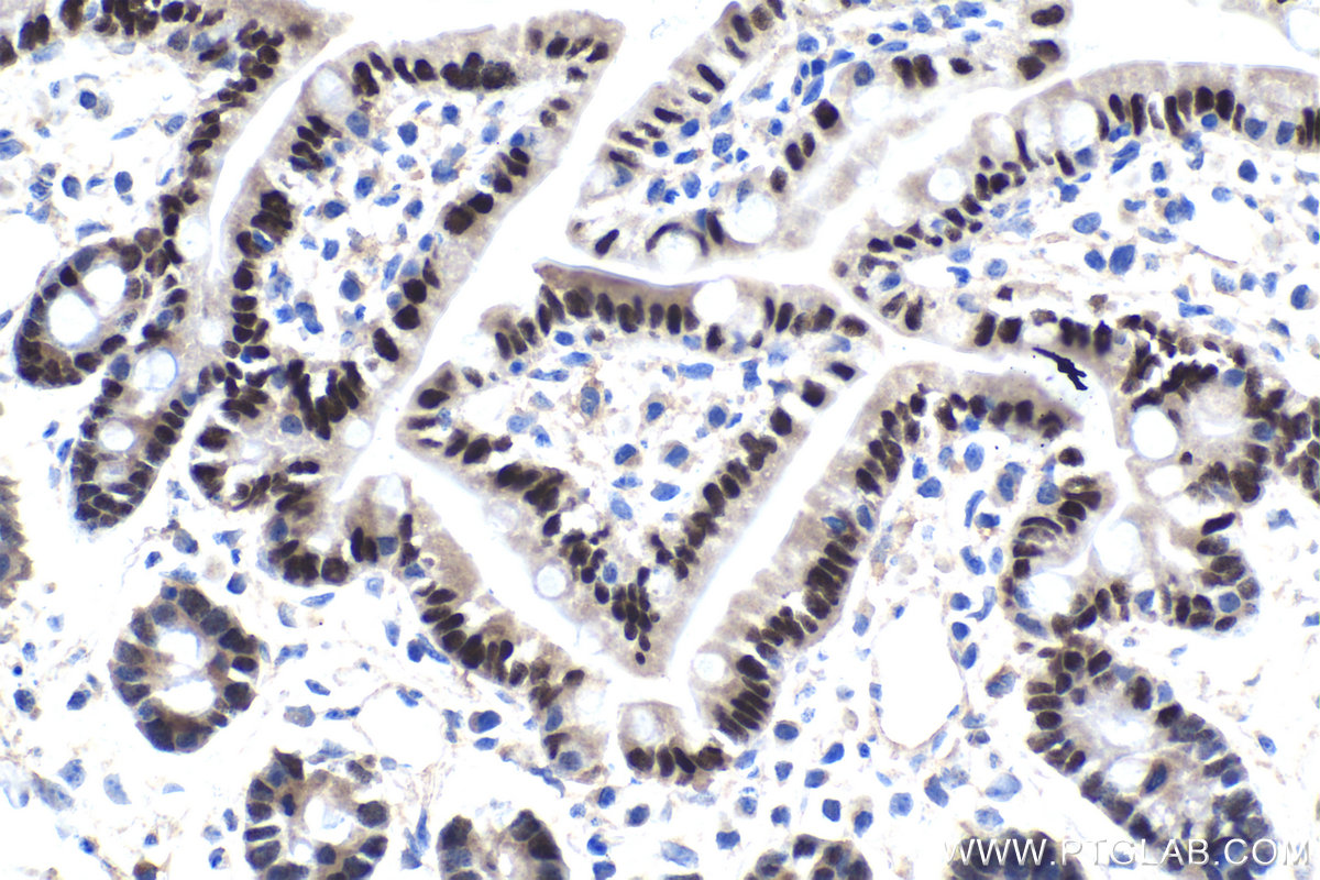 IHC staining of mouse small intestine using 25801-1-AP