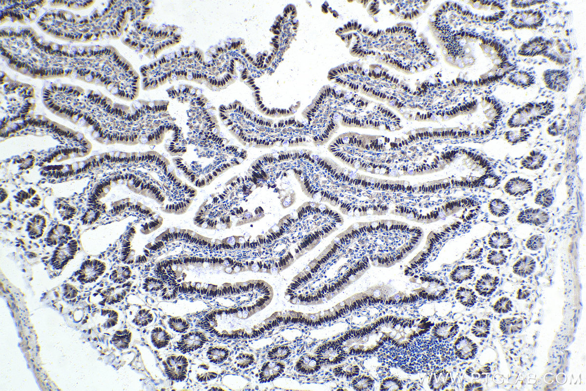 IHC staining of rat small intestine using 25801-1-AP