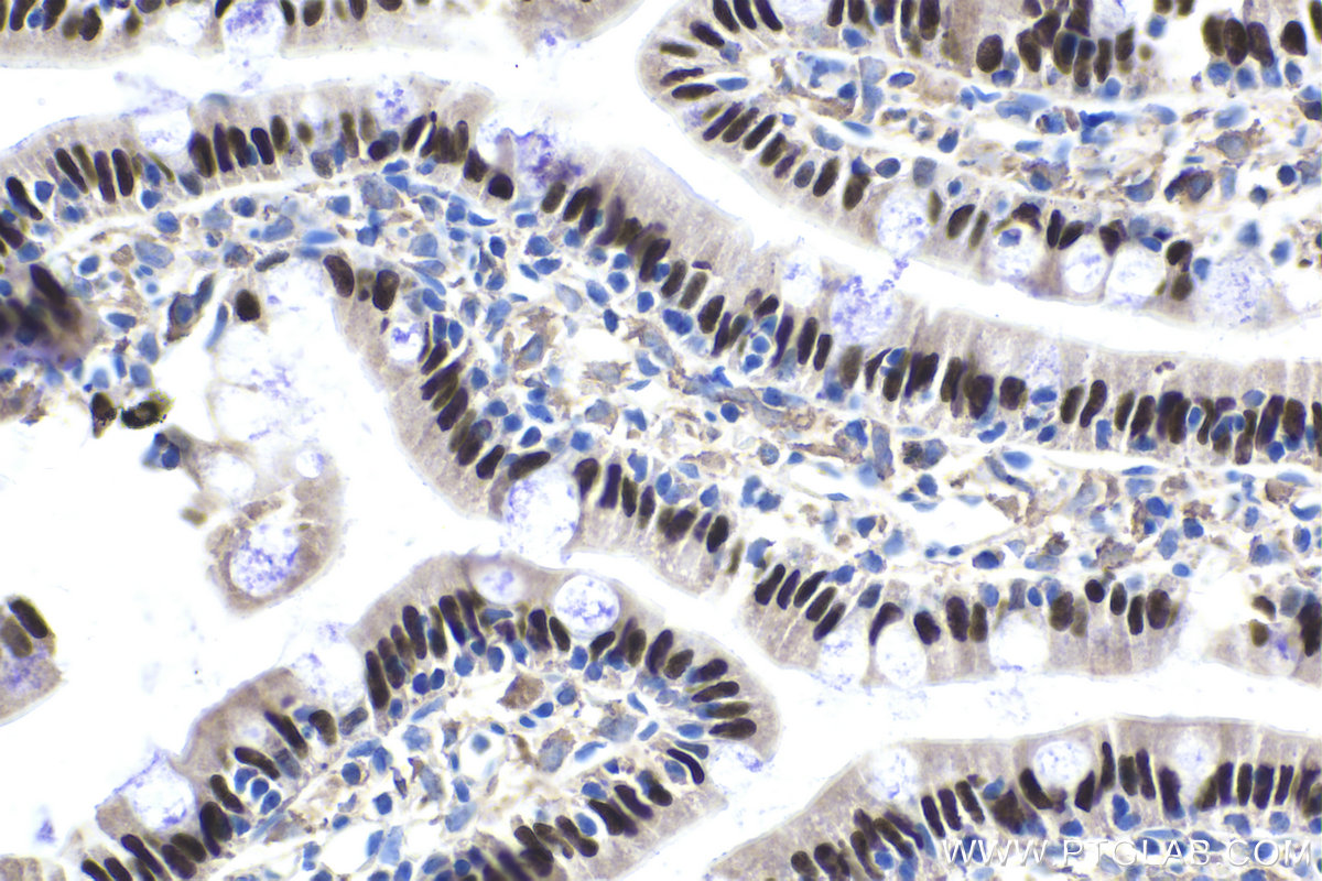 IHC staining of rat small intestine using 25801-1-AP