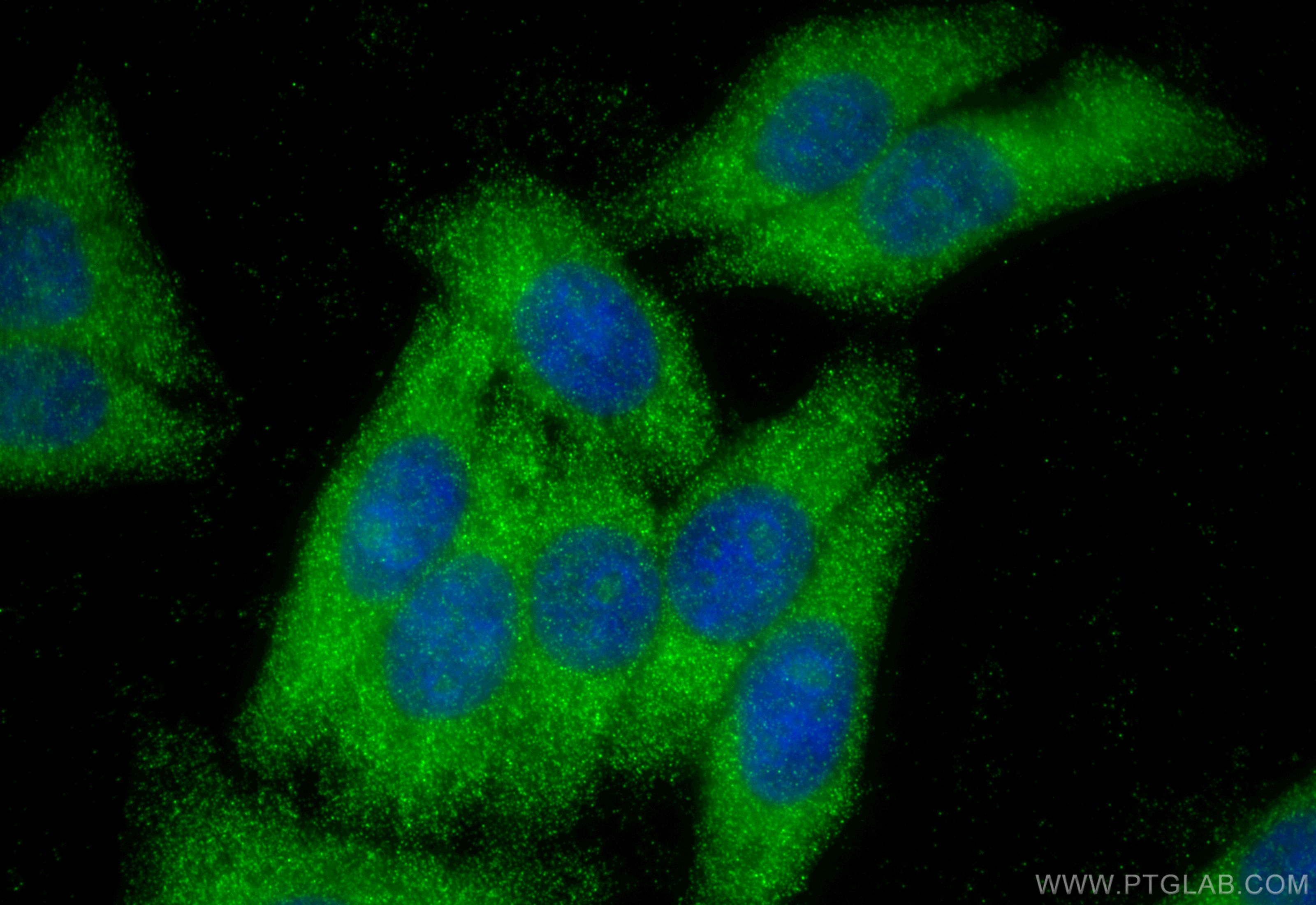 IF Staining of HepG2 using 11874-1-AP