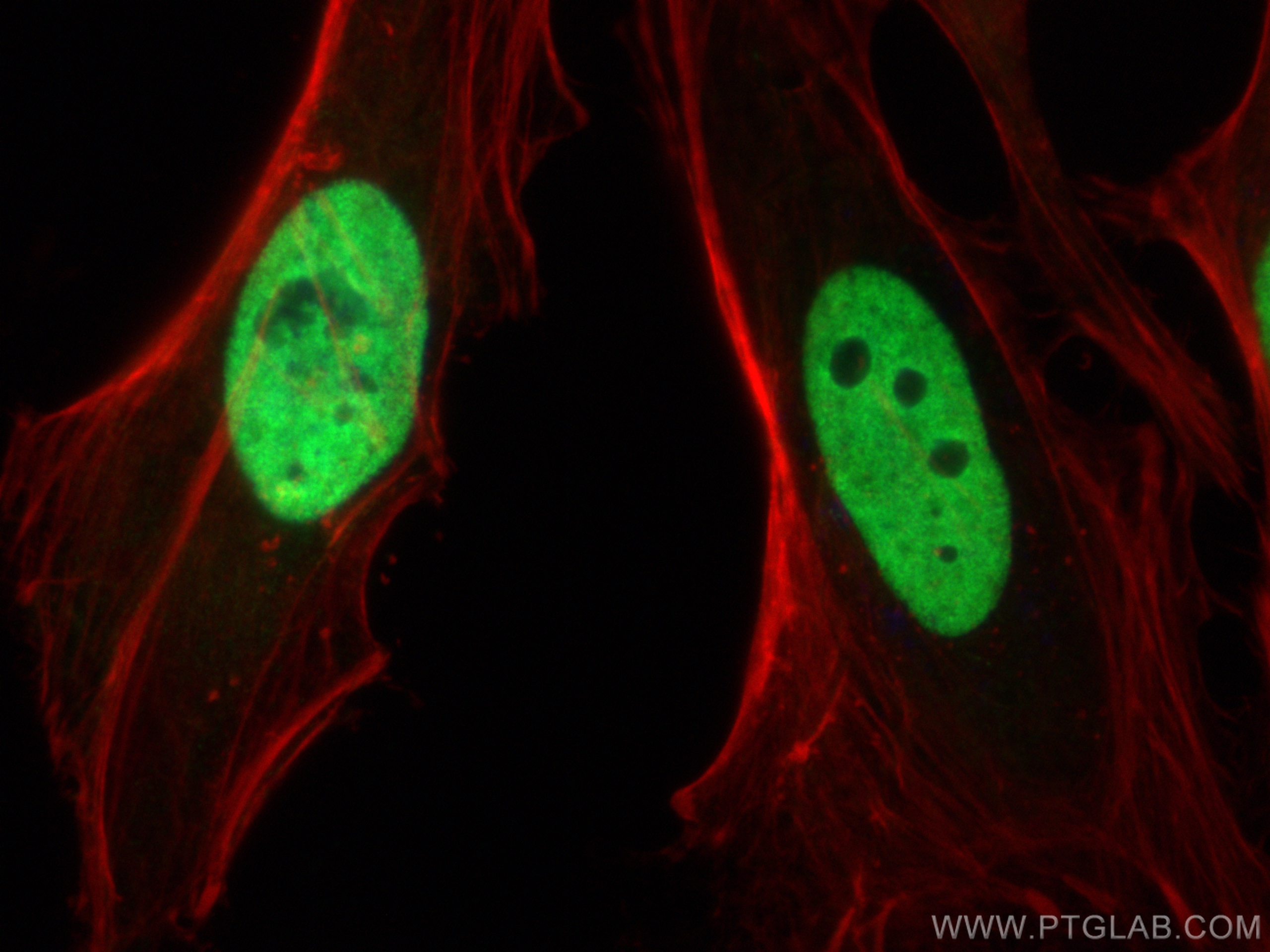 IF Staining of HeLa using 11176-1-AP